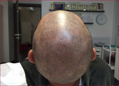 trucco permanente torino