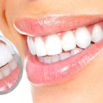 Come avere denti sani e bianchi