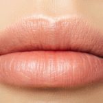Botox e filler alle labbra ai minori di 18 anni in Inghilterra