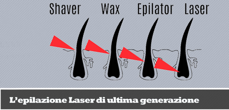 depilazione permanente e duratura