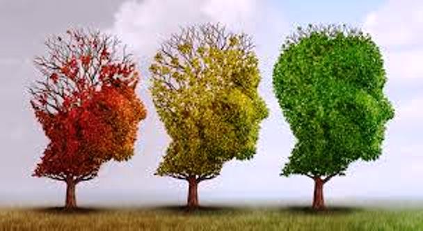 Alzheimer