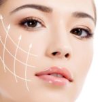 Agolifting: il trattamento di ringiovanimento del viso meno invasivo