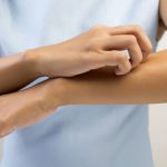 Come spegnere il prurito: le novità da una ricerca italiana