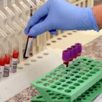 Cardiologia: tre marcatori predicono il futuro dei pazienti con scompenso