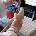 Nuove speranze contro il cancro al pancreas