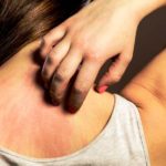 Il prurito: ecco come nasce