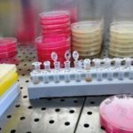 Uno studio dell’università di Verona individua in Dab2 un predittore di metastasi
