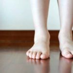 Piedi piatti: quando il plantare ortopedico è utile