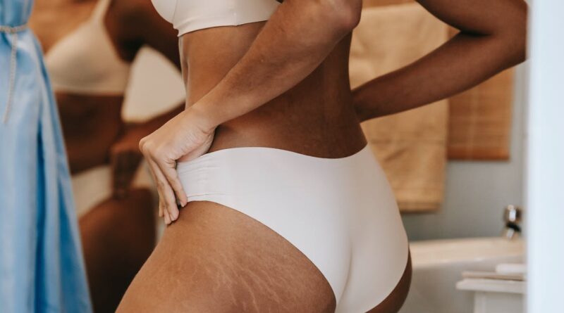 cellulite